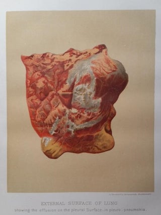 Report of the Commissioner of Agriculture on the Diseases of Cattle in the United States